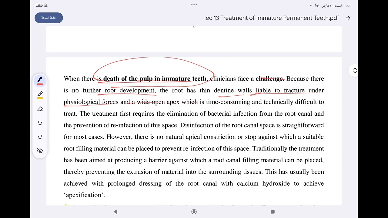 Pedodontics lec 13 treatment of immature permanent teeth with pulpal necrosis مرحلة رابعة طب أسنان