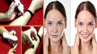 How to use Mole Removal Pen | Skin Tags and Mole removal Pen Demo