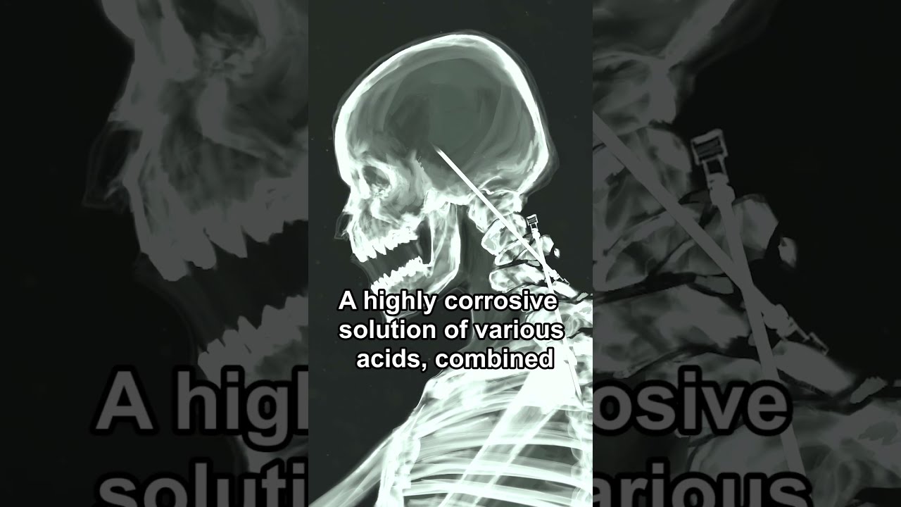 SCP 096 IS DEAD 