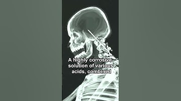 SCP-096 IS DEAD!!!