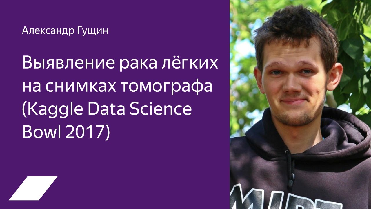 Kaggle Data Science Bowl 2017 Kaggle data science bowl 2017