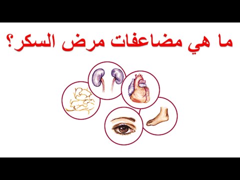 فيديو: كيف يؤثر السكر على الجسم