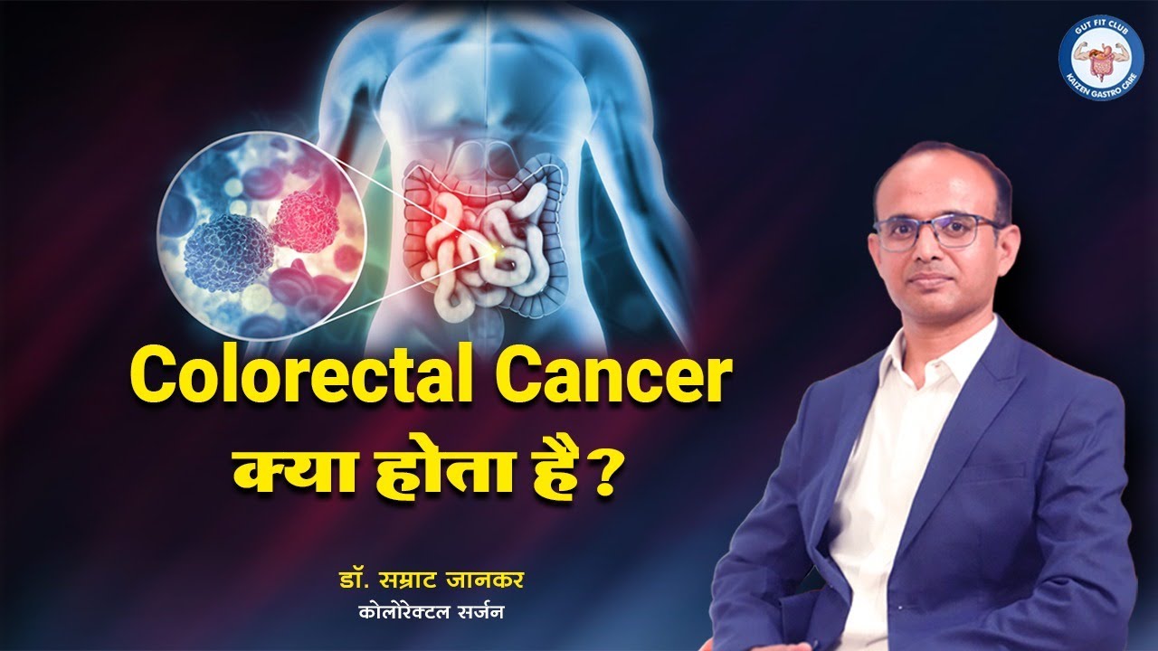 What is Colorectal Cancer? Symptoms, Testing, Prevention, And Treatment in Hindi - Dr. Samrat Jankar