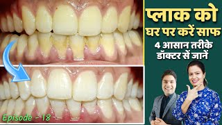 removal of plaque from teeth home remedy | danto ka plaque kaise hataye | दांतों की सफाई Episode –18