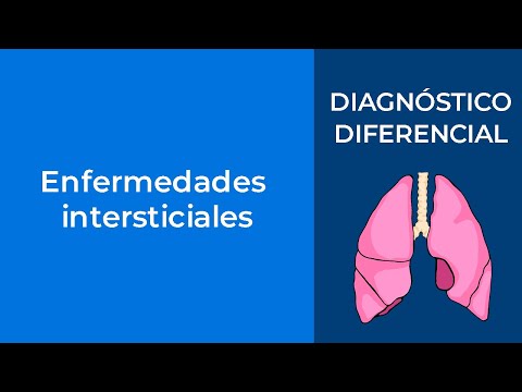 Vídeo: El Valor Diagnóstico Del Lavado Broncoalveolar En Enfermedades Pulmonares Intersticiales