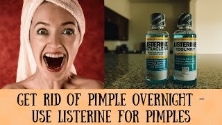 Get Rid Of Pimple Overnight - Use Listerine For Pimples About Ladies