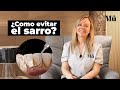 🟡🦷🤢 ¿Cómo evitar el SARRO en los dientes?