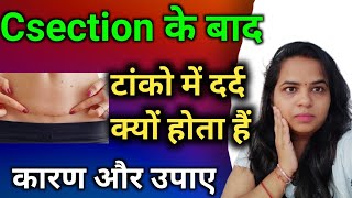 सिजेरियन डिलीवरी के बाद टांको में दर्द और सूजन | csection delivery ke baad tanko me dard or sujan