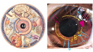 Iris Reading - True Brown Eyes, Brain Fog, Pituitary & Pineal, How Trauma May Manifest in The Iris