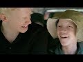 Born Too White Being Albino In East Africa Medical Documentary Reel Truth Science