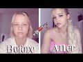 DIY at home plastic surgery / trying Amber Scholls tips