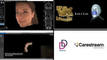 Carestream CS9600 CS8100 CS3600