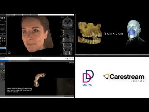 Carestream CS9600 CS8100