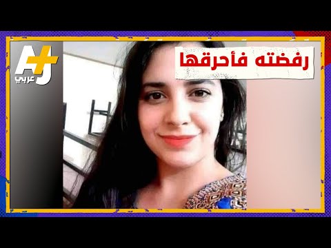 بعد أن أحرقها لأنها رفضت الزواج به ريما الجزائرية تبدأ رحلة علاجها 