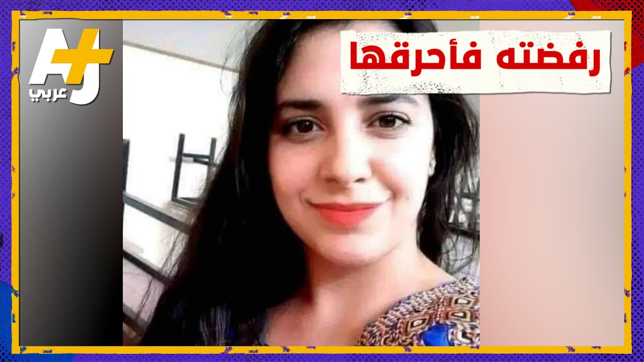 بعد أن أحرقها  لأنها رفضت الزواج به، ريما الجزائرية تبدأ رحلة علاجها