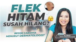 CARA MENGHILANGKAN FLEK HITAM DENGAN TEPAT | Edukasi-Kulit EP.2