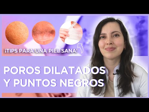 Vídeo: Puntos Negros Frente A Puntos Blancos: ¿Cuál Es La Diferencia?