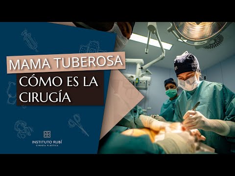 Video: ¿Cubrirá el seguro la reconstrucción mamaria tubular?