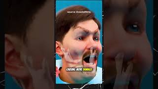 Why Are Brass Knuckles So Deadly?