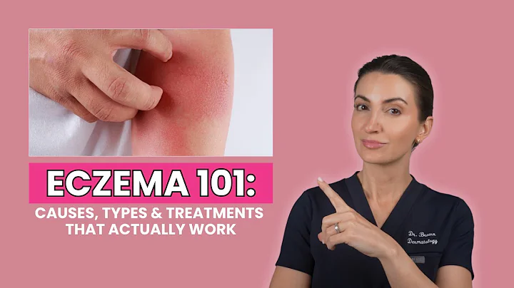 Eczema Explained by a Dermatologist: Types, Triggers, and Treatments That Work