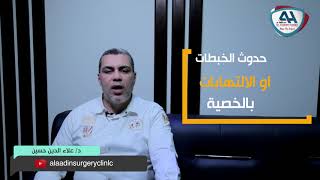 تعريف القيلة المائية وأسبابها والأعراض والعلاج