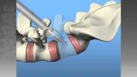 PERPOS PLS System Animation