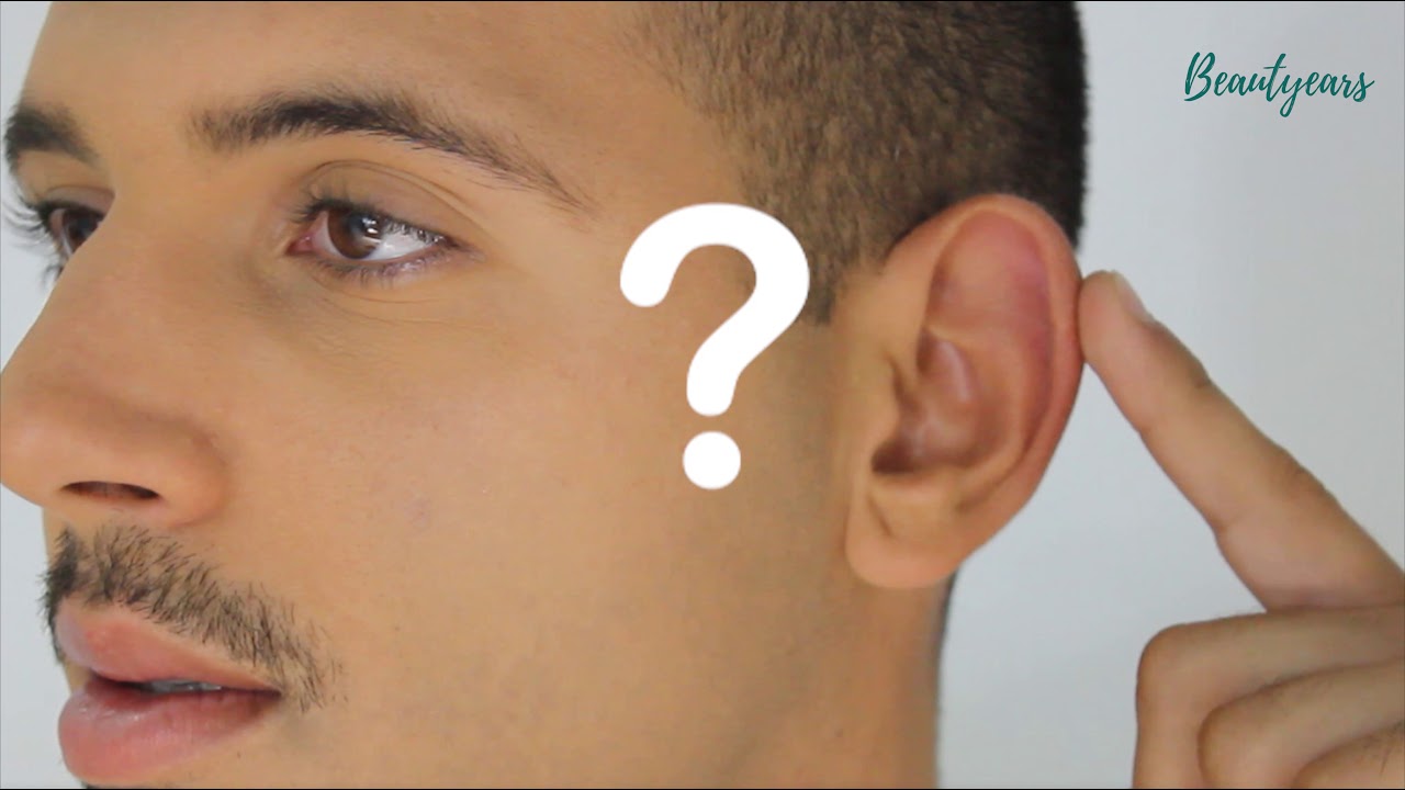 Como corrigir as orelhas de abano sem cirurgia ? - YouTube