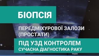 Біопсія простати (передміхурової залози) - промежинна, ф'южн біопсія - уролог Вітрук Ю.В.