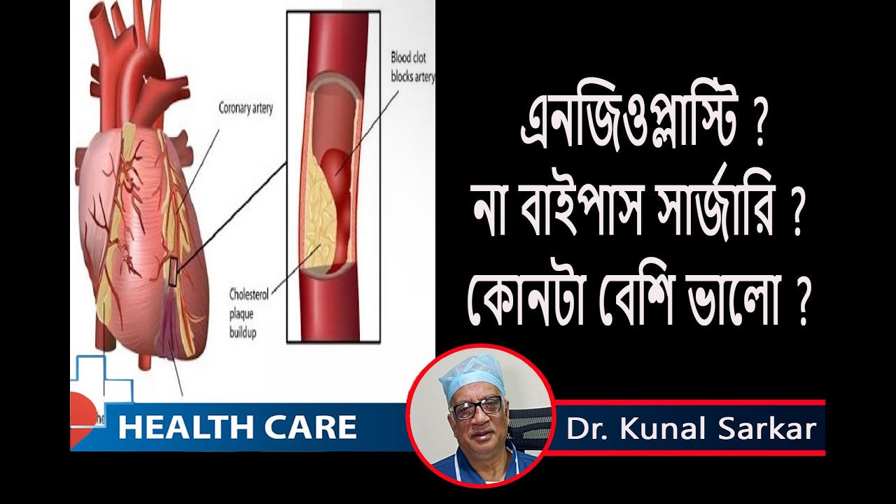 এনজিওপ্লাস্টি  না বাইপাস  সার্জারি কোনটি  কোন পরিস্থিতে  করা  ভালো || Dr. Kunal Sarkar