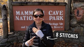 I got injured at Mammoth Cave National Park