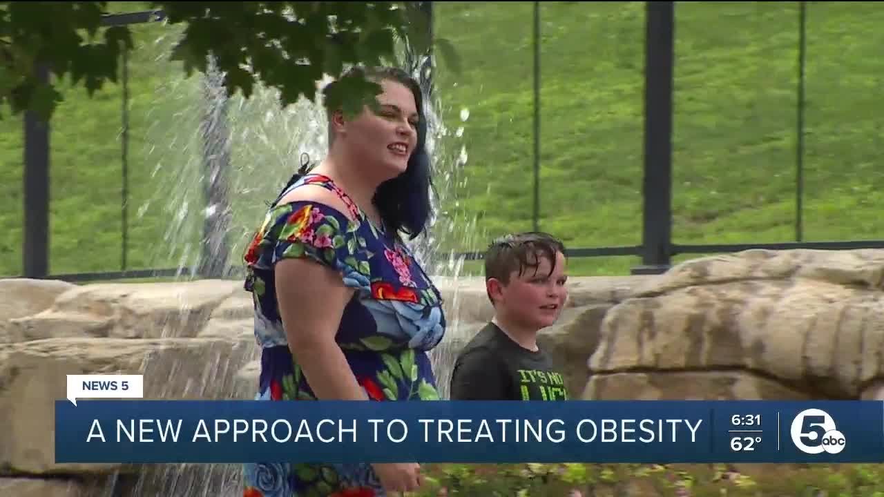A new approach to treating obesity - YouTube