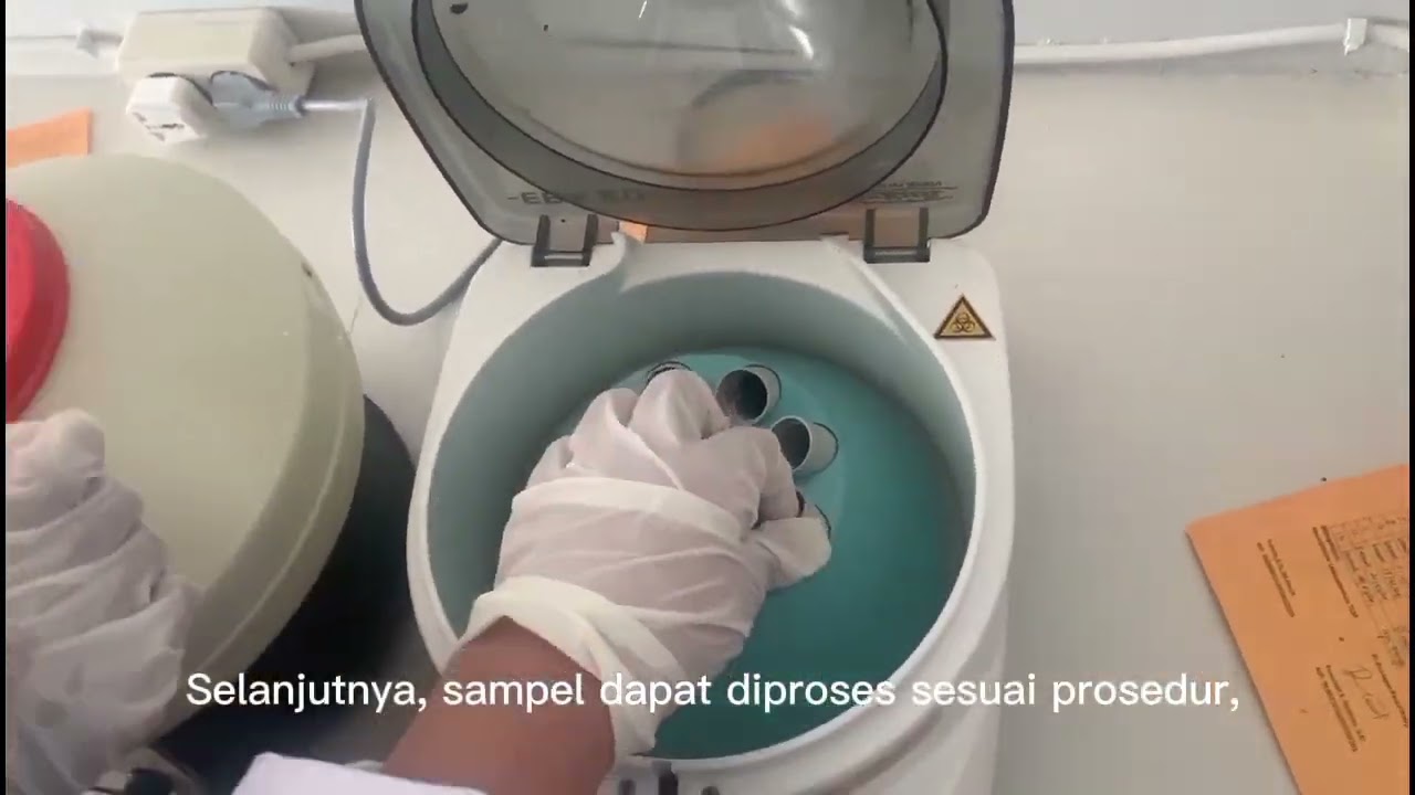 Pemeriksaan GDP(Gula Darah Puasa) dan GD2PP (Gula Darah 2jam Postprandial)