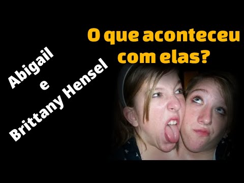 Vídeo: As gêmeas siamesas abby e brittany são casadas?