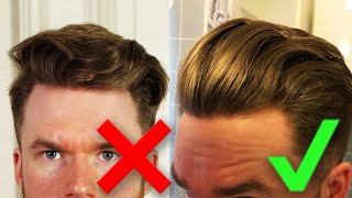 Haare übergang männer ohne Frisur Ohne