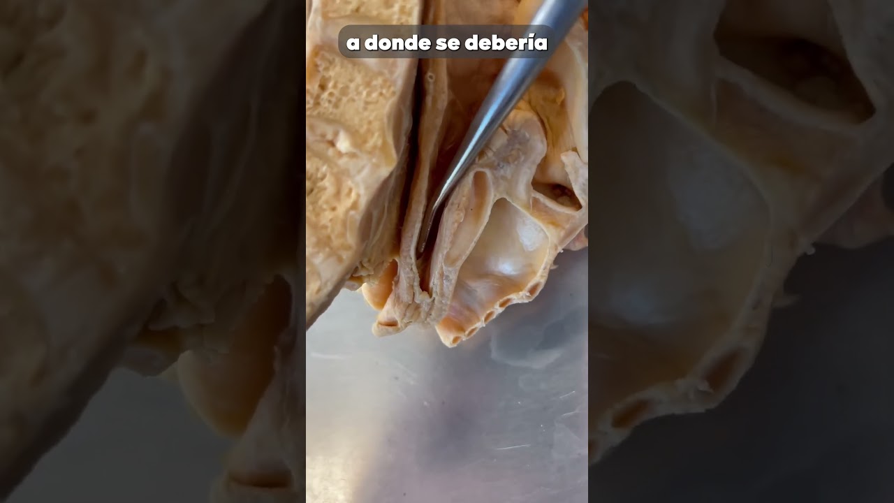 Agua por el camino equivocado   