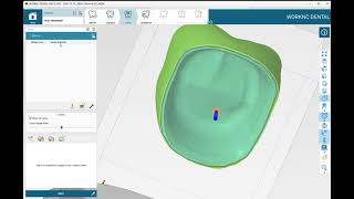 How to use the worknc
