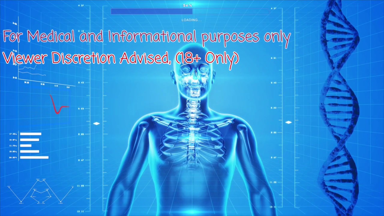 Mars Hydro TS1000 "4x4 Flower setup" Green Bodhi