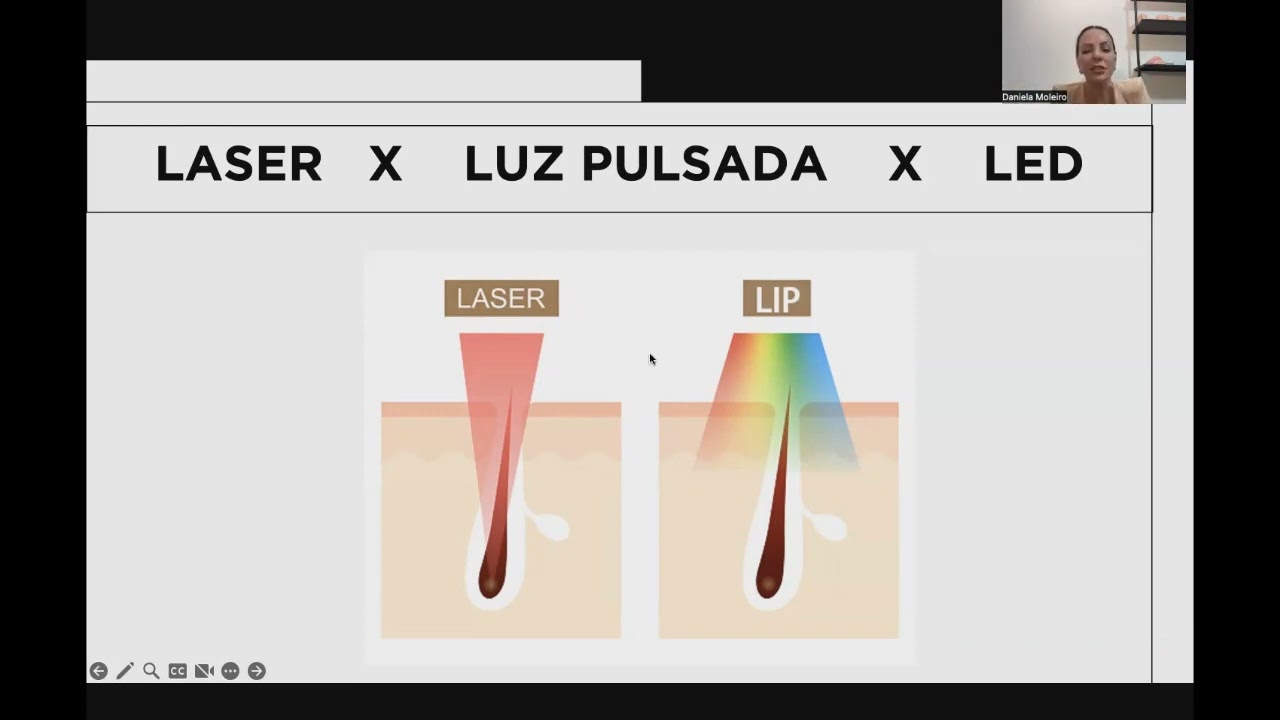 LASER NDYAG NOS TRATAMENTOS ESTÉTICOS PROTOCOLO REMOVE