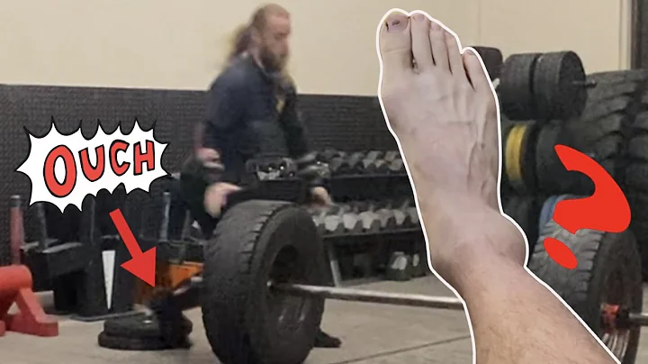 I Hurt Myself -  What Now?