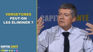 Vergetures, Peut-On Les Éliminer ? 2 Minutes Pour Comprendre