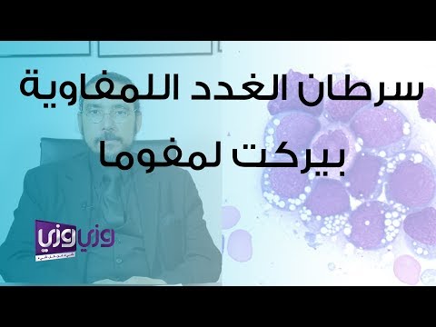 سرطان الغدد اللمفاوية بيركت لمفوما