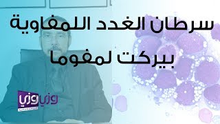 سرطان الغدد اللمفاوية بيركت لمفوما