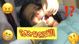 التقويم بوجع؟ 😬 | 😧?Braces Pains