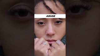 MARIJUANA - Why a Schedule 1 Drug?