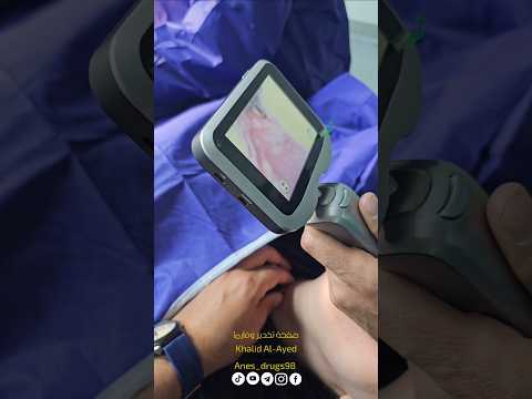 عملية التنبيب الرغامي بالفديو Video Laryngoscope And Intubation Anesthesia