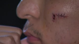 Man with special needs lured to date and robbed