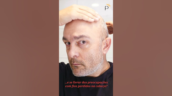 Te ajudamos com a careca! 👨‍🦲