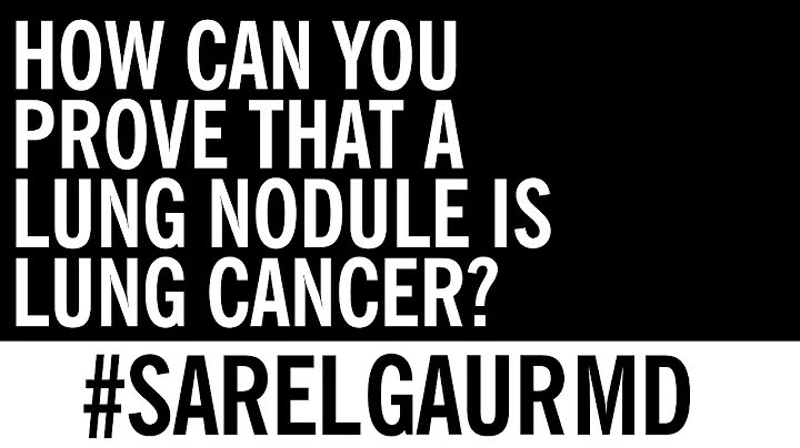 How can you prove that a Lung Nodule is Lung Cancer? - DayDayNews