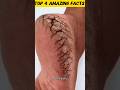 Dark Body Problems? Try These Simple Home Facts!😊💯#facts #healthfacts #youtubeshorts