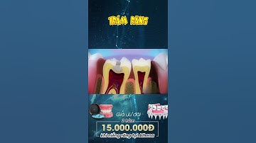 [3D] TRÁM RĂNG || Nha Khoa Quốc Tế Athena